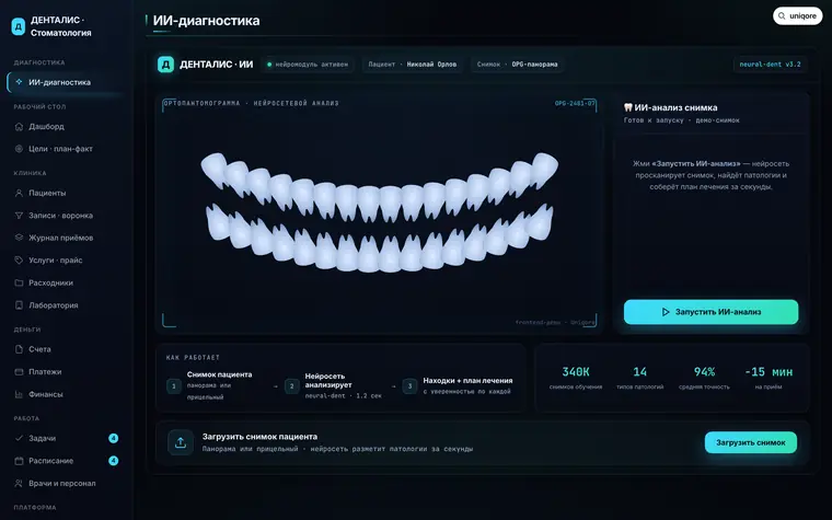 CRM «Денталис»: ИИ-разбор снимка и план лечения